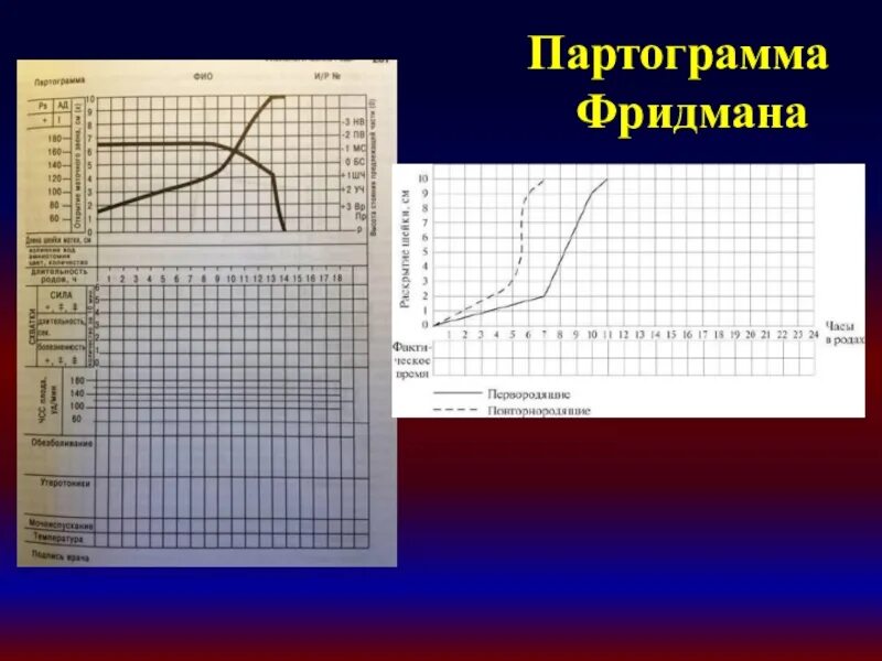 Партограмма 1 периода родов. Партограмма для ведения родов. Партограмма. Акушерская партограмма. Первичная слабость родовой деятельности партограмма.