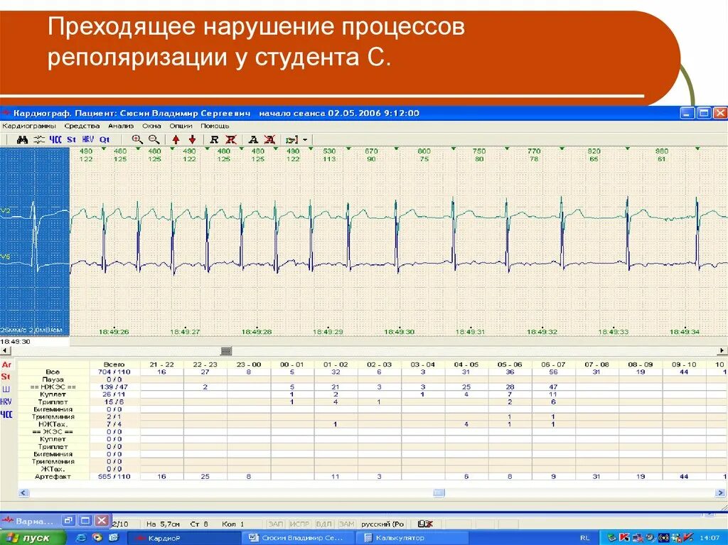 Умеренные изменения реполяризации