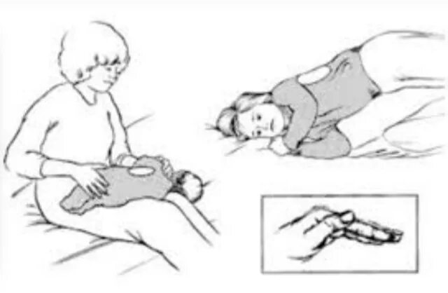 Позиционный (Постуральный) дренаж. Вибрационный массаж для детей для отхождения мокроты грудничку. Вибрационный массаж для детей для отхождения мокроты 2 года. Постуральный дренаж бронхоэктатической болезни. Постуральный массаж