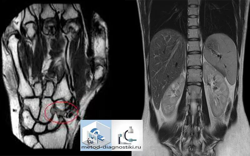 Делают ли мрт руки. Мрт лучезапястного сустава.