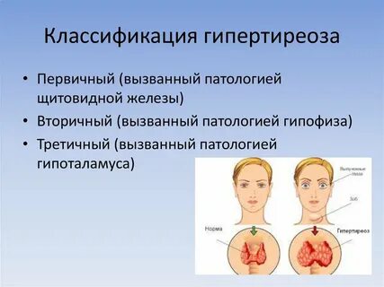 Щитовидная железа педиатрия