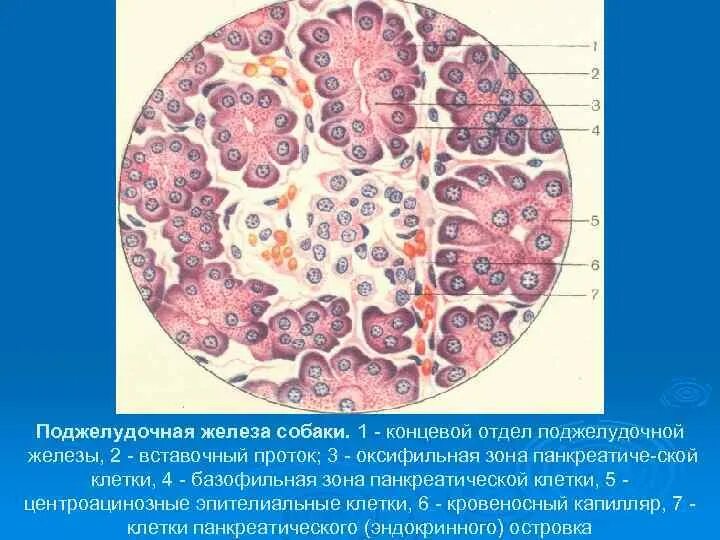 Ацинарноклеточная карцинома поджелудочной железы гистология. Ацинарные клетки поджелудочной железы гистология. Поджелудочная железа собаки. Центроацинозные клетки поджелудочной. Поджелудочная железа свиньи