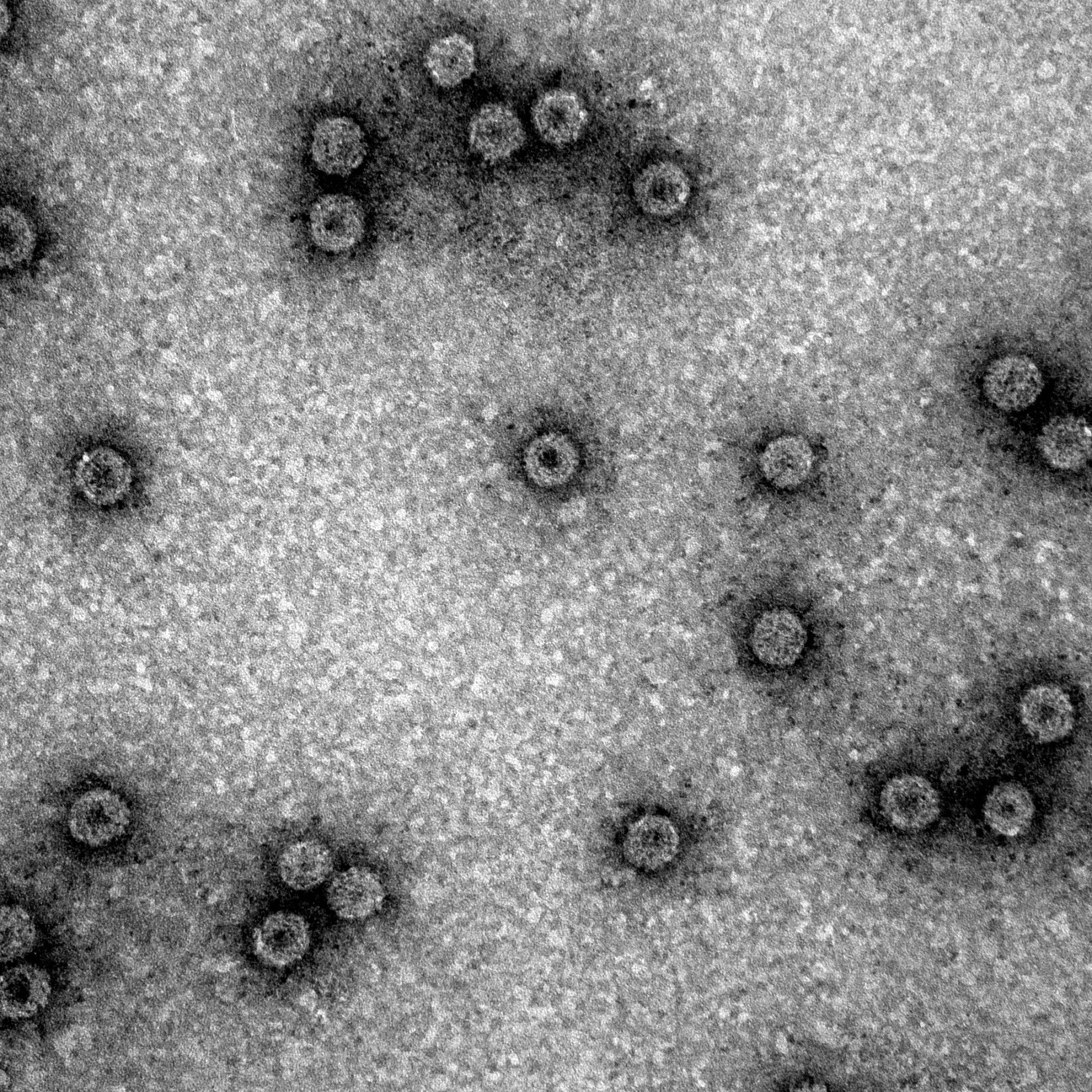 File:CCMVWT.jpg - parts.igem.org