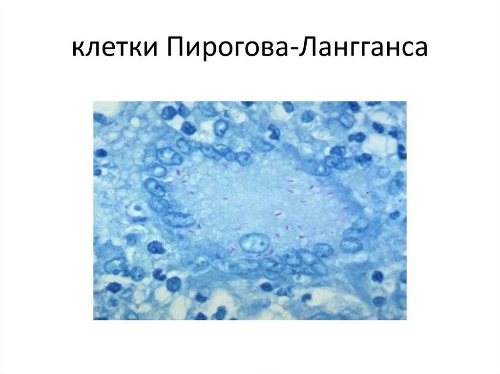 Клетка типа инородных тел. Клетка типа инородных тел