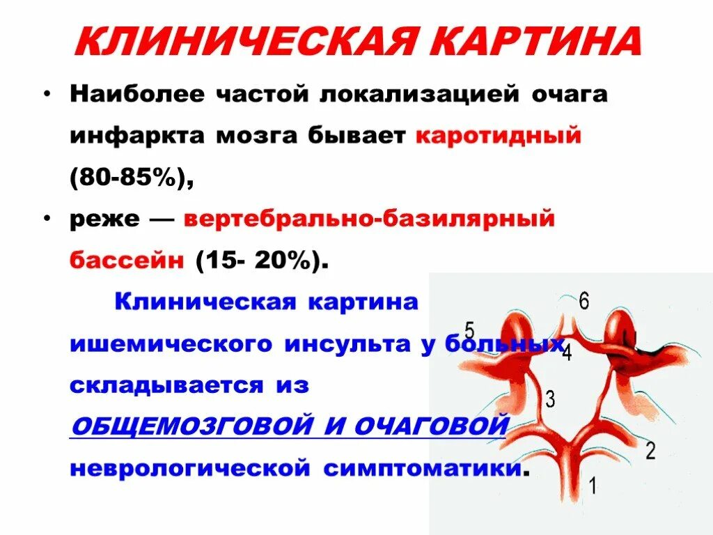 Инфаркт мозга причины. Клинические симптомы инфаркта миокарда. Инфаркт мозга. Клинические проявления. Локализация инфаркта головного мозга. Исходы ишемического инфаркта мозга.