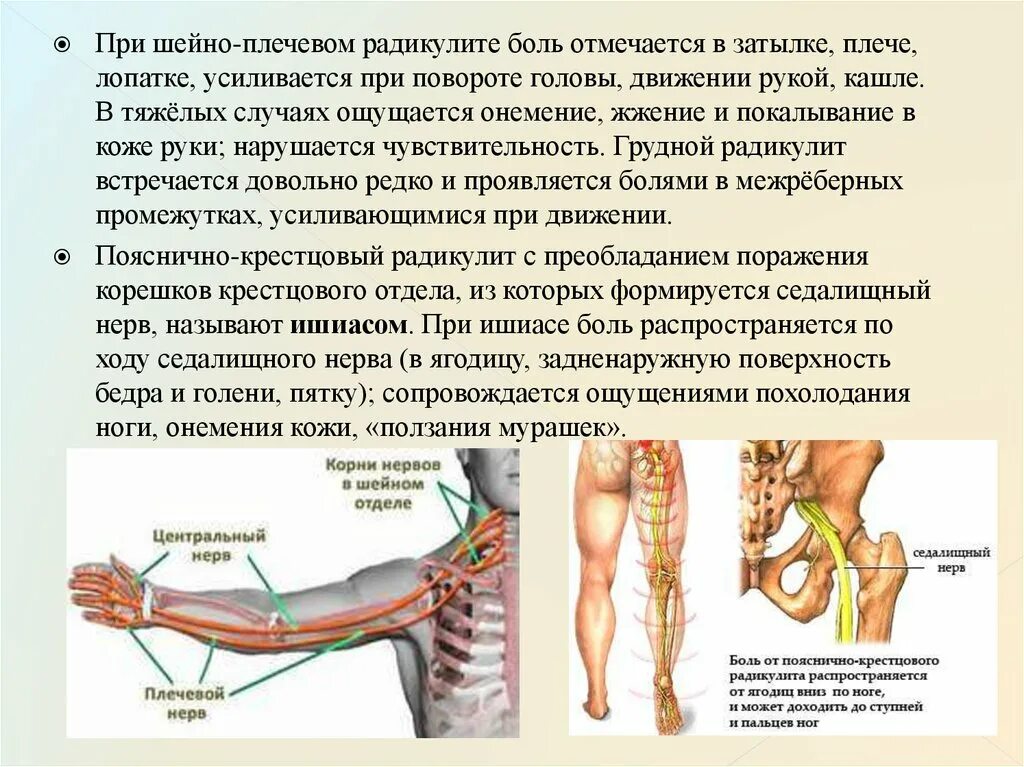 Защемление нерва можно ли массаж