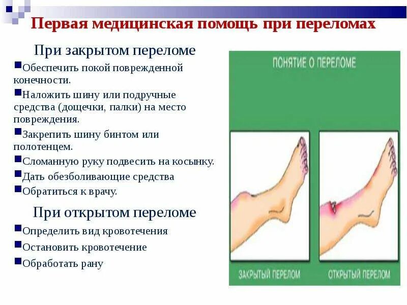 Первая помощь при различных видах травм. Травмы конечностей первая помощь. признаки травмы конечности.