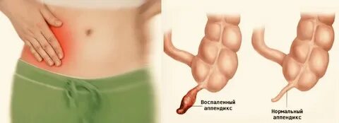 Сквирт құрастыру