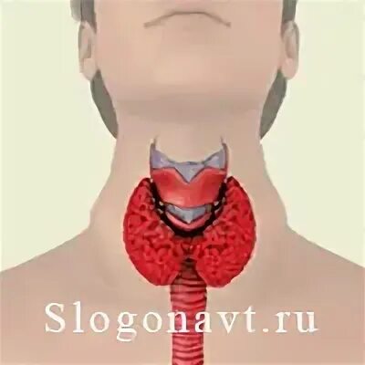 5 диффузный зоб