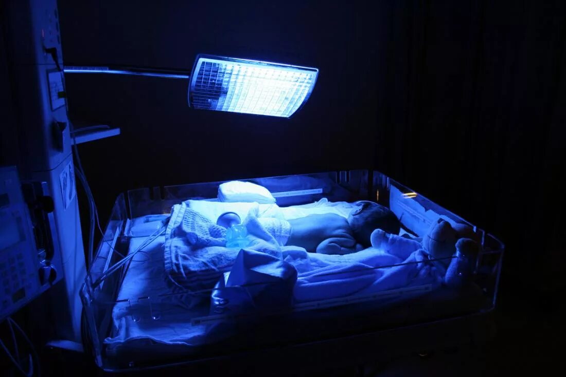 Лампа для фототерапии новорожденных. Фототерапия для новорожденных при желтухе. Фототерапия билирубин.