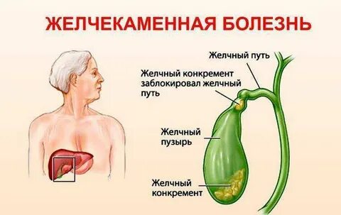 Заболевание печени и желчевыводящих путей лечение