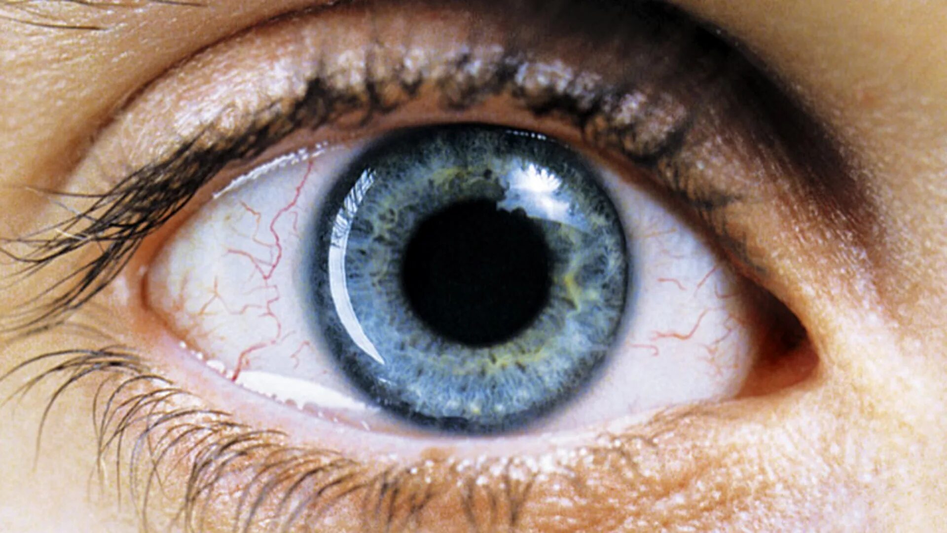 зрачок человека расширяется. расширенные зрачки при коме. расширенные зрачки кома. расширенный зрачок не реагирует на свет. алкогольная кома причины.