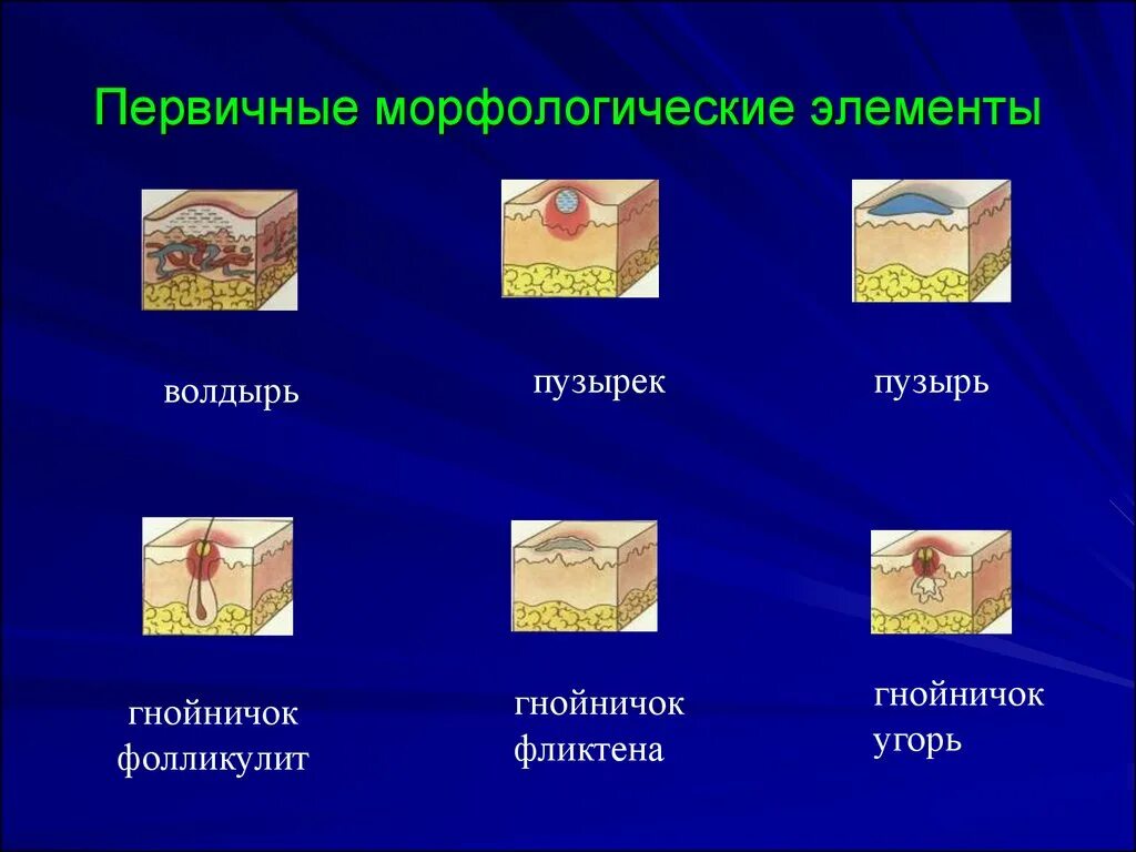 Вторичные элементы. Первичные морфологические элементы кожной сыпи. вторичные морфологические элементы кожи дерматовенерология. морфологические элементы сыпи дерматовенерология. первичные морфологические элементы кожи волдырь.