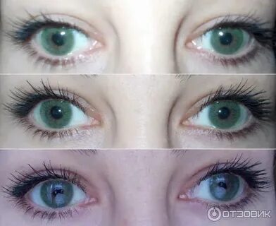 Факичные линзы отзывы