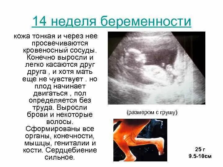 Матка в 14 недель. 14 Недель размер ребенка. 12-14 Недель беременности. Плод на 14 неделе беременности. 13 14 Недель беременности размер плода.