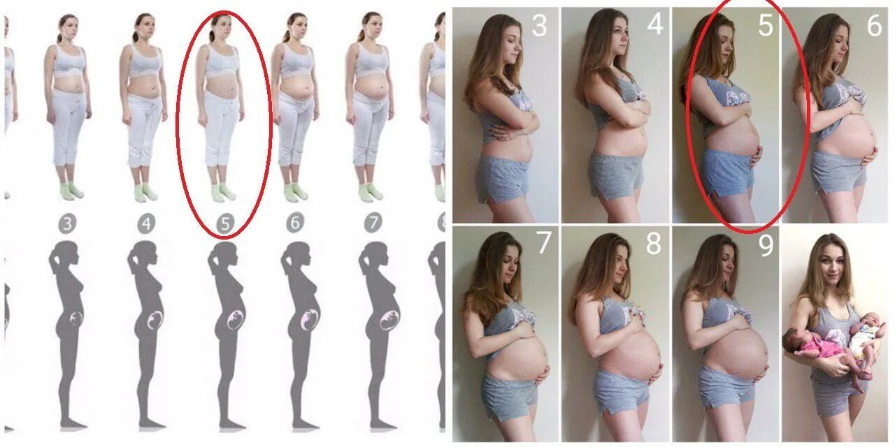 Какой живот при двойне. Какой живот при двойне. Какой живот при двойне. Какой живот при двойне. Какой живот при двойне.