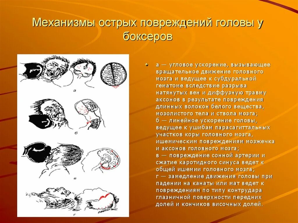 Механизм повреждения травмы. Ушиб головного мозга механизм травмы. Разрывы мозга у боксёров.