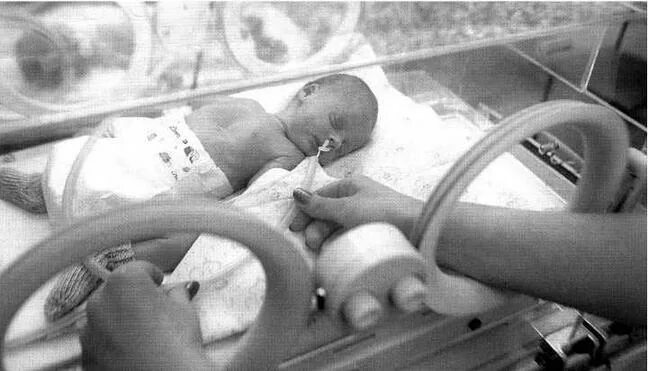 В 6 месяцев рожают. Самый недоношенный ребенок. Семимесячные дети недоношенные. Килограммовые дети недоношенных. Недоношенный ребёнок 1500гр.