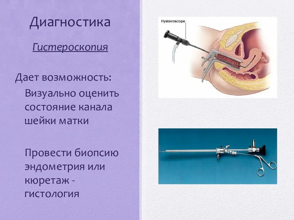 Кюретаж в гинекологии. Гистероскопия с биопсией эндометрия. Гистероскопия диагнозы.