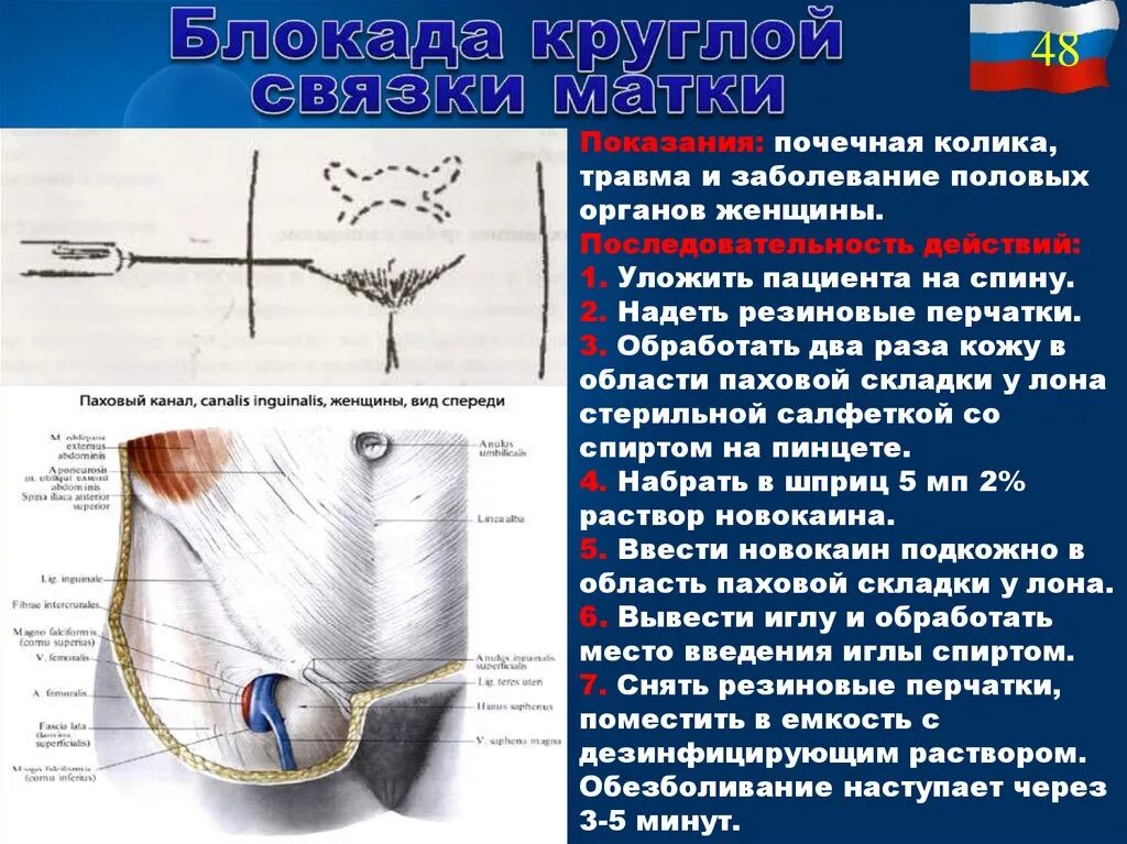 Блокады половые. Травмы женских половых органов. Блокада круглой связки матки. Травмы мужских половых органов. Повреждения женских наружных половых органов.