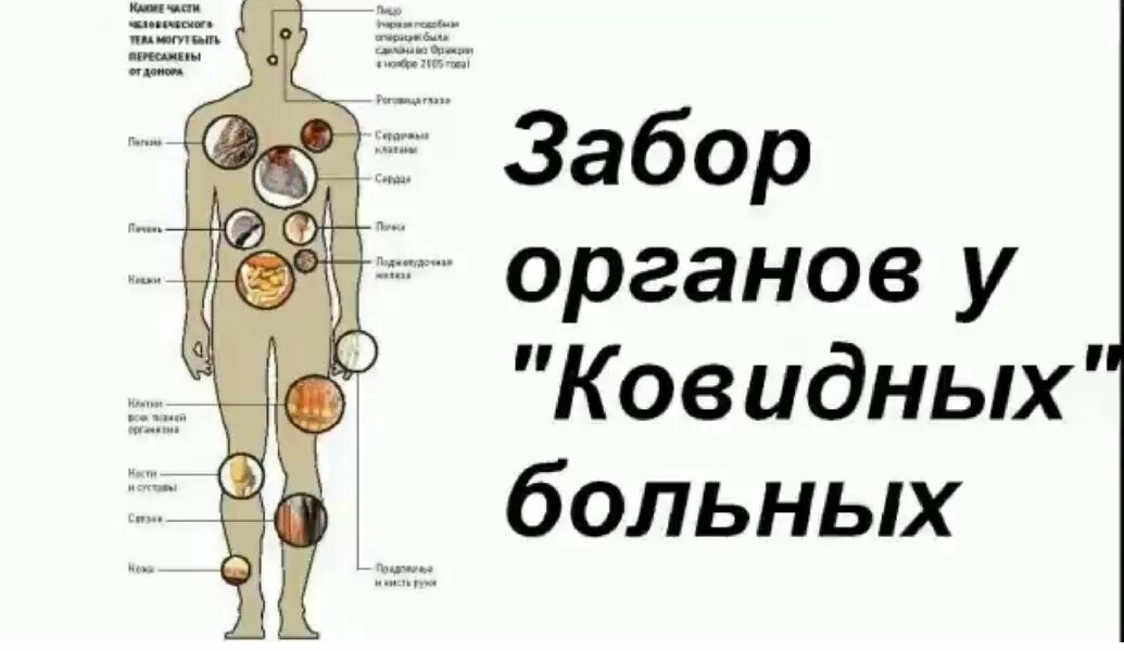 Какие органы пересаживают. Какие органы можно пересадить человеку. Сколько стоят внутренние органы. Что можно пересадить человеку от человека.