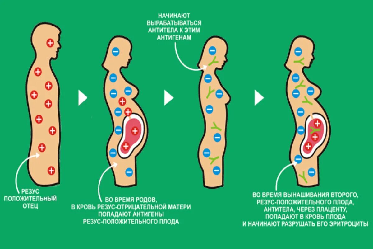 Муж положительный жена отрицательный беременность. Конфликт резус факторов при беременности у родителей. Положительный резус фактор матери и отрицательный плода. Несовпадение резус факторов матери и ребенка. Резус конфликт рисунок.