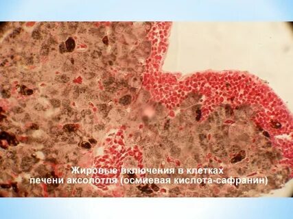 Какие клетки печени