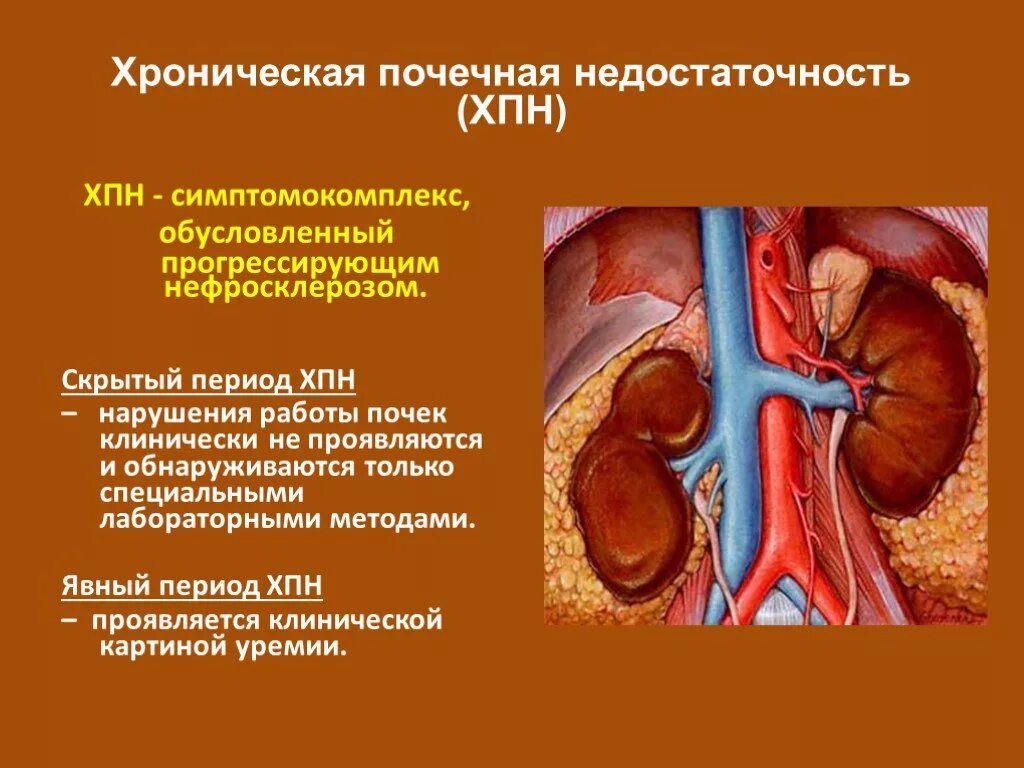 Ишемия почек. Хроническая почечная недостаточность. Хроническая почечная недостаточность (ХПН). Аренальная почечная недостаточность.