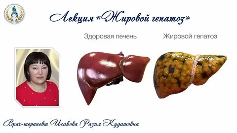 Дистрофия печени мкб 10