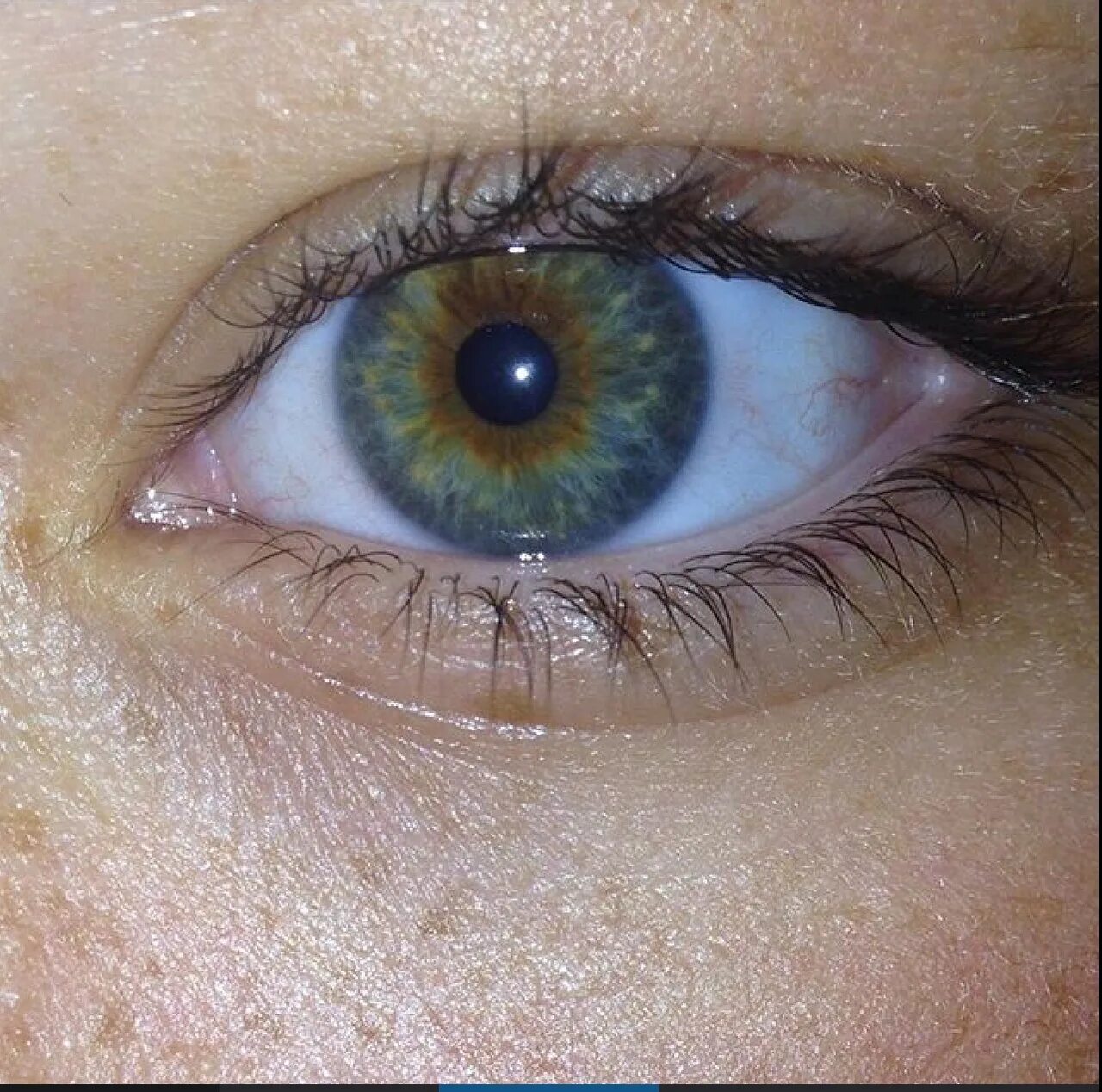 Зелено голубо желтые глаза. Центральная гетерохромия глаз. Гетерохромия центральной Радужки. Центральная гетерохромия зрачок. Центральная гетерохромия серый Карий.