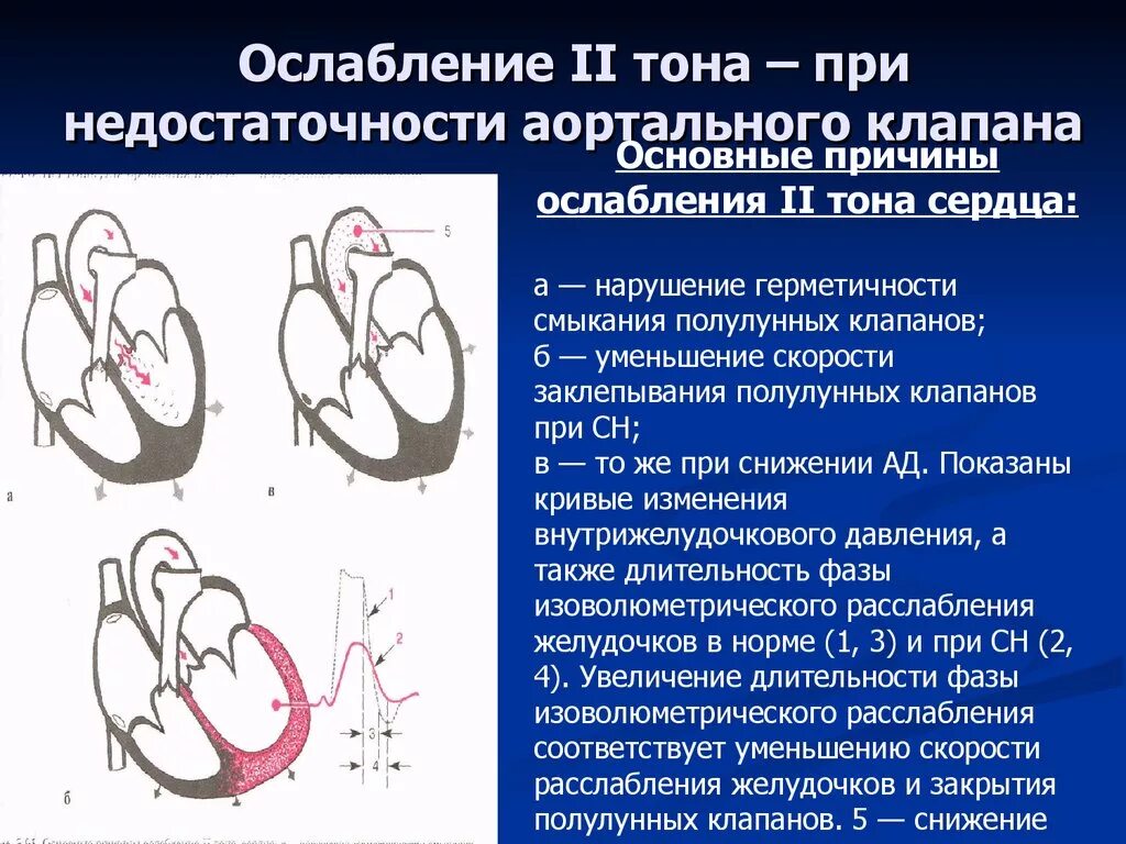 Тоны на аорте. Акцент 2 тона над легочной аортой. Ослабление 2 тона на легочной артерии. Тоны на аорте. Дополнительные тоны сердца.