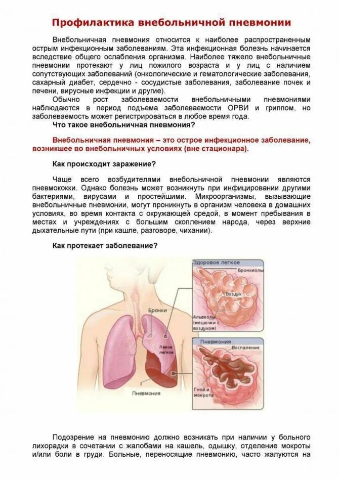 Как получить воспаление легких