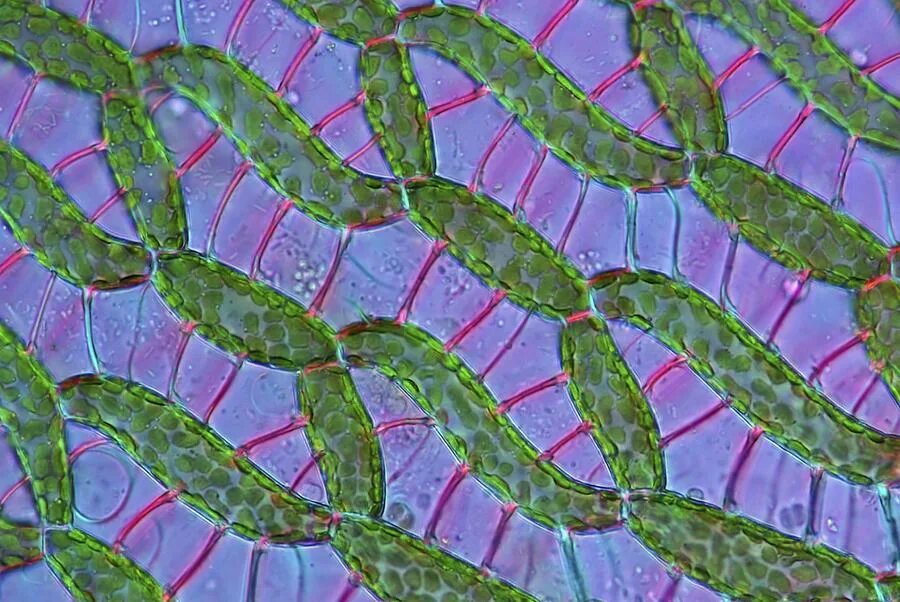 Водоносные клетки в листьях имеет. Мох сфагнум под микроскопом. Клетки листа сфагнума. Клетки сфагнума под микроскопом. Лист мха сфагнума под микроскопом.