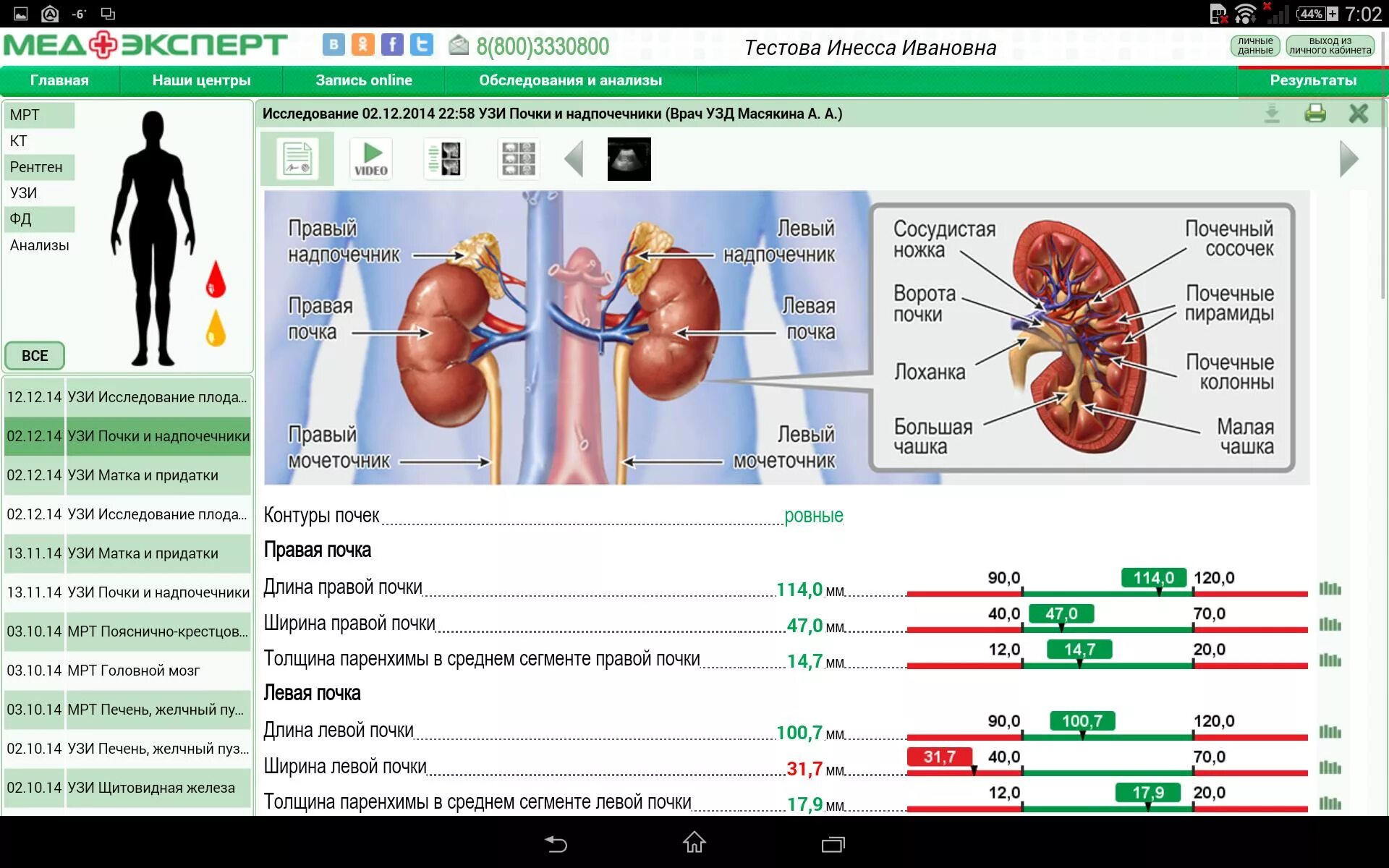 Медэксперт результаты анализов личный кабинет. МЕДЭКСПЕРТ. МЕДЭКСПЕРТ Воронеж личный кабинет. МЕДЭКСПЕРТ УЗИ. Пароль МЕДЭКСПЕРТ.