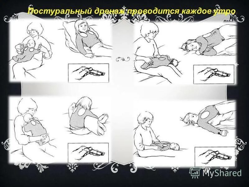 Массаж при мокроте у взрослых. Постуральный дренаж вибрационный массаж детям. дренажный массаж для детей при бронхите. массаж при бронхите у детей. дренажный массаж при бронхите.