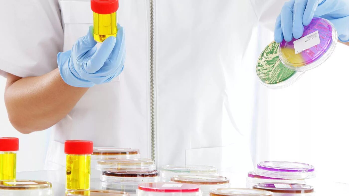 Бактериоскопическое исследование микробиология. Посев кала на чашки петри. Бактериальная инфекция. Посев крови. Чашки петри бактериология.