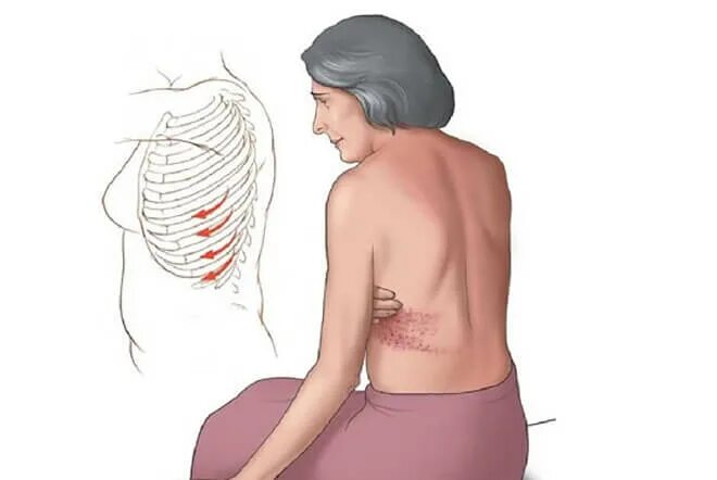 Боль в спине. Ребра со стороны спины. Болит спина с левой стороны.