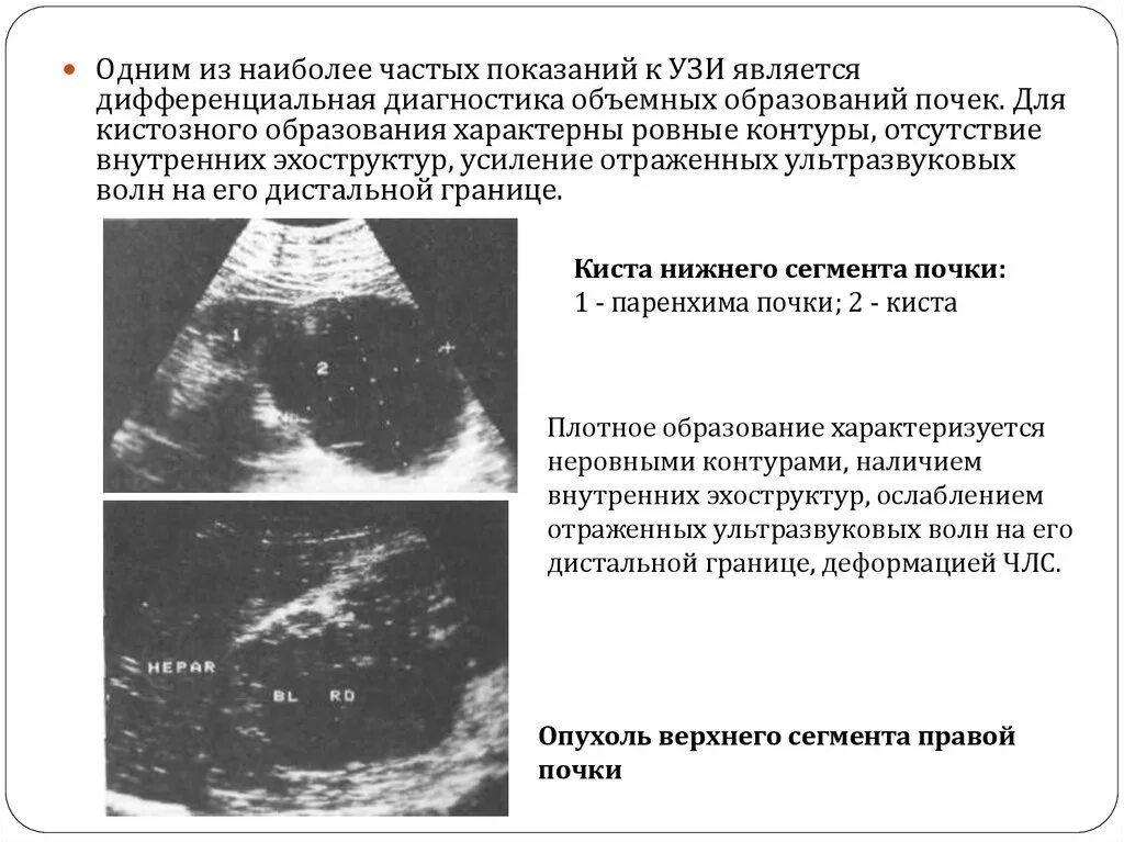 Узи почек диагнозы. УЗИ почек гидронефроз заключение. Гидронефроз почки УЗИ протокол. Киста почки УЗИ протокол. Поликистоз почек УЗИ протокол.