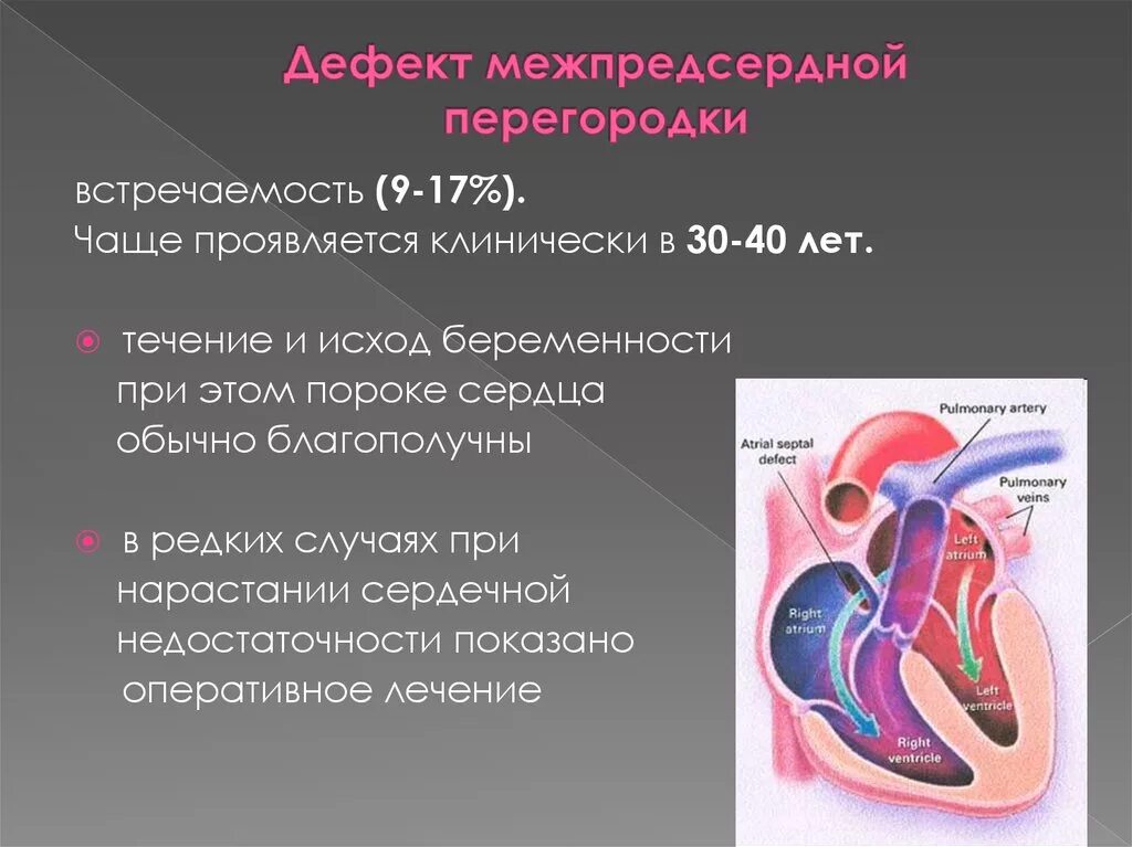 Межпредсердная перегородка сердца строение. Дефект межпредсердной перегородки гемодинамика патогенез. Дефект межпредсердной и межжелудочковой перегородки. Гемодинамика ДМПП У детей.