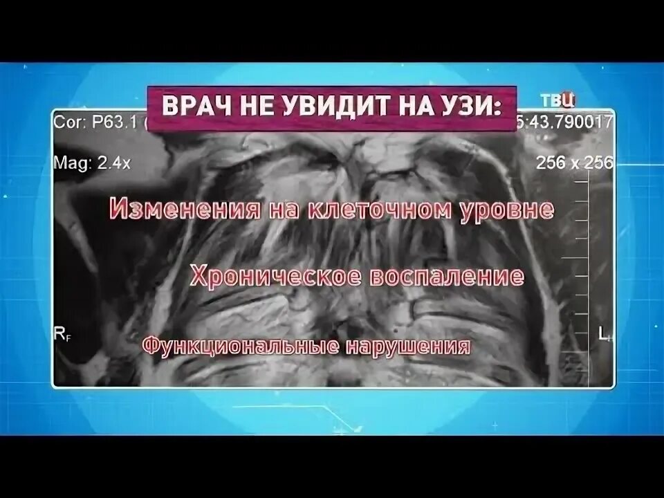 Ответы врачей на узи. Узи почек изранов лекции по узи. Тесты на категорию по узи с ответами для врачей 2022. Ответы врачей на узи. Ответы врачей на узи.