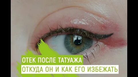 Татуаж отек