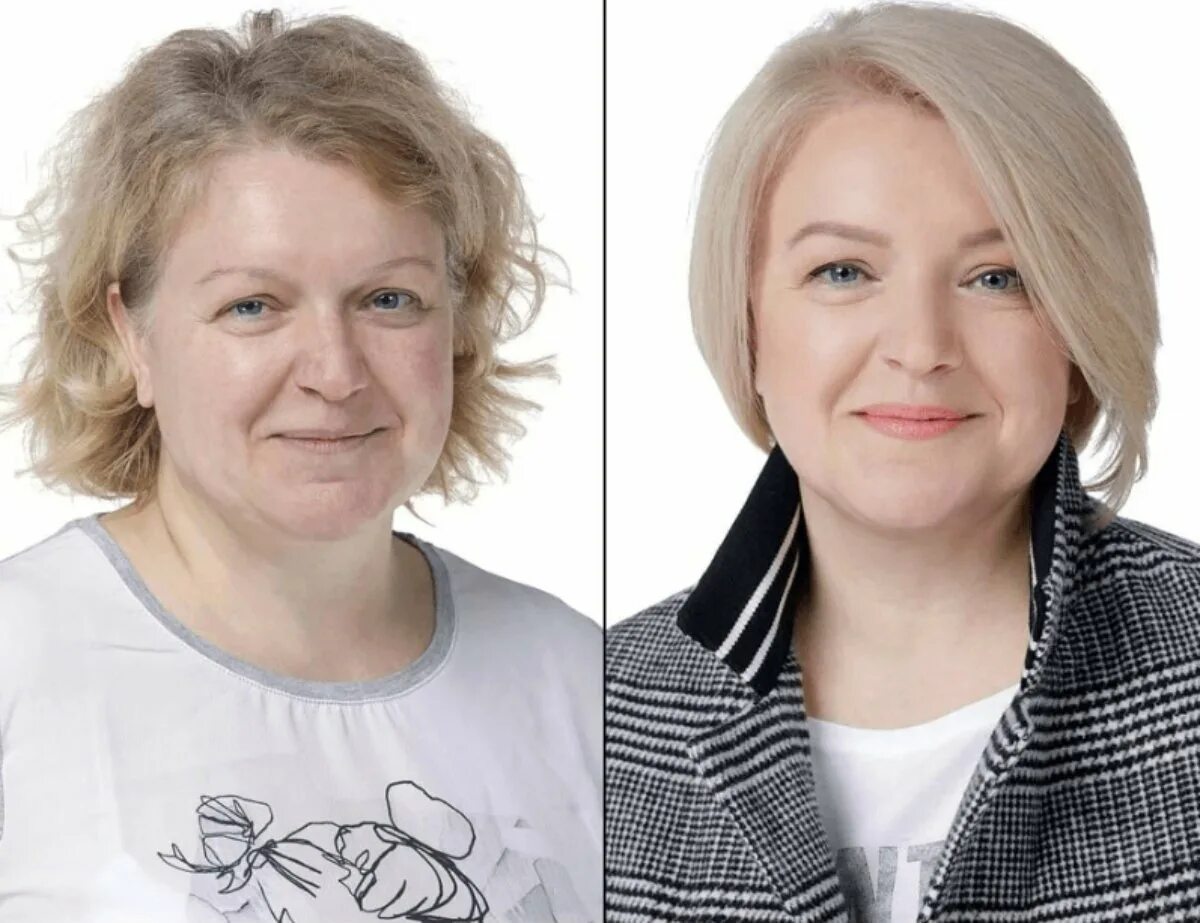 Подбородок в 50 лет