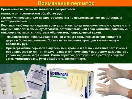 Рука когда менять