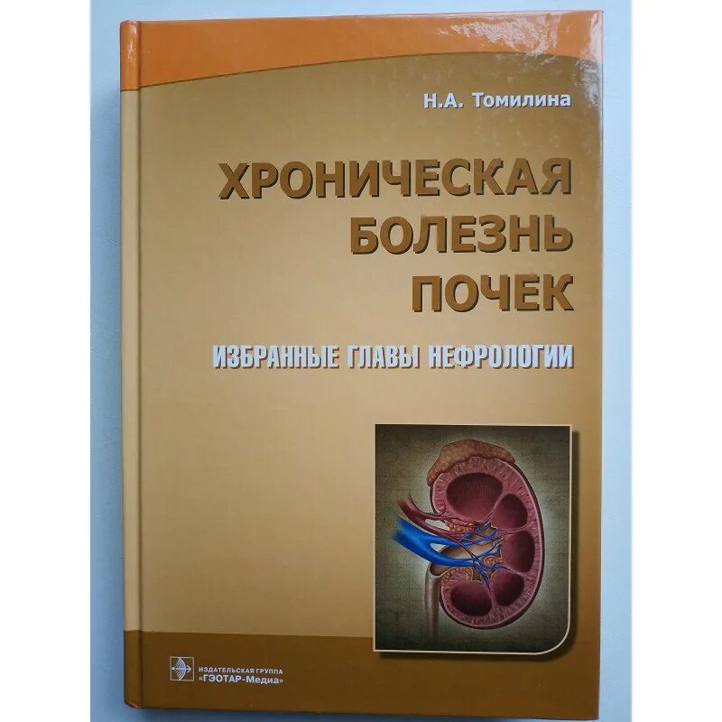 Болезни почек книга. Хроническая болезнь почек Томилина главы. Учебник по заболеваниям почек. Нефрология ХБП.