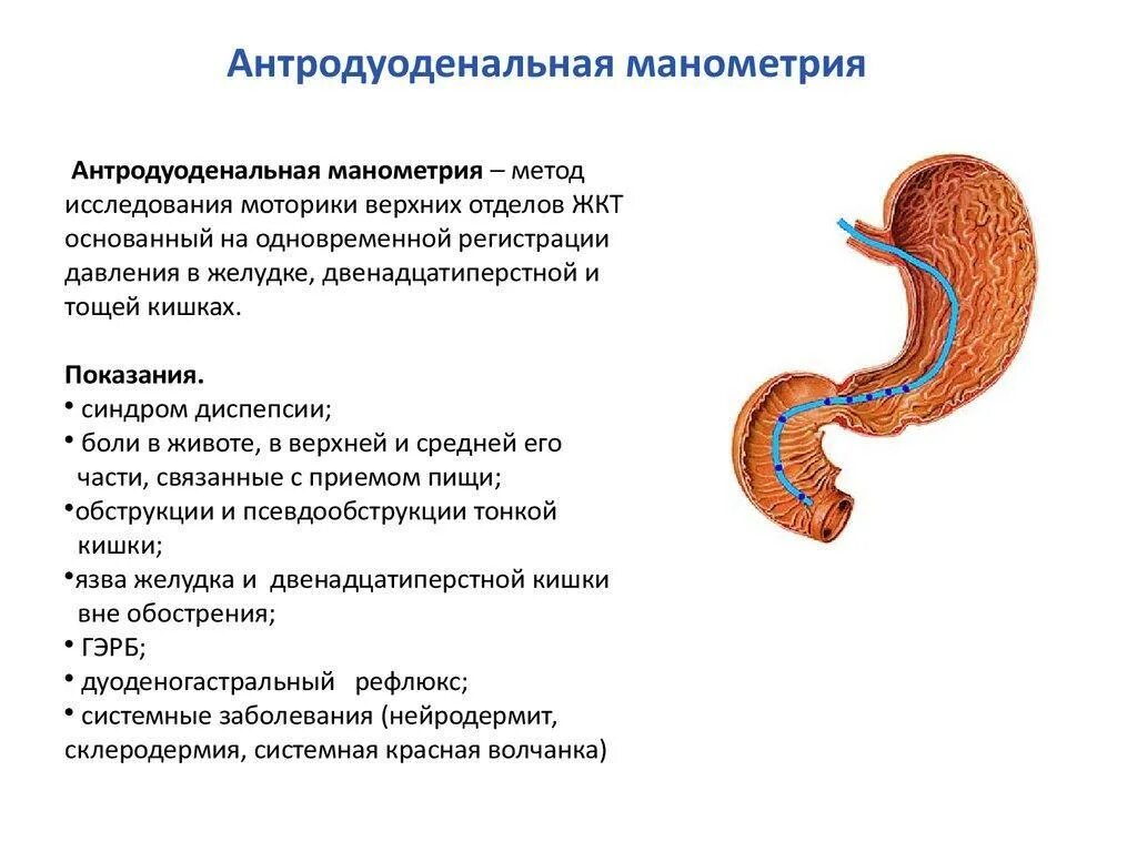 Моторика желудка и кишечника. Эзофагеальная манометрия. Функциональные исследования желудочно-кишечного тракта.. Манометрия органов ЖКТ - это исследование. Антродуоденальная манометрия.