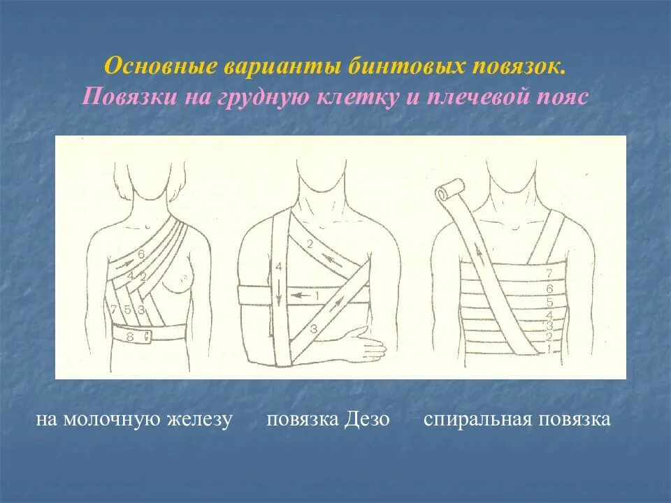 Плечевая повязка алгоритм. Бинтовая повязка на грудную клетку. Спиральная повязка на грудь. Наложение повязки на грудь. Наложить повязку на грудную клетку.