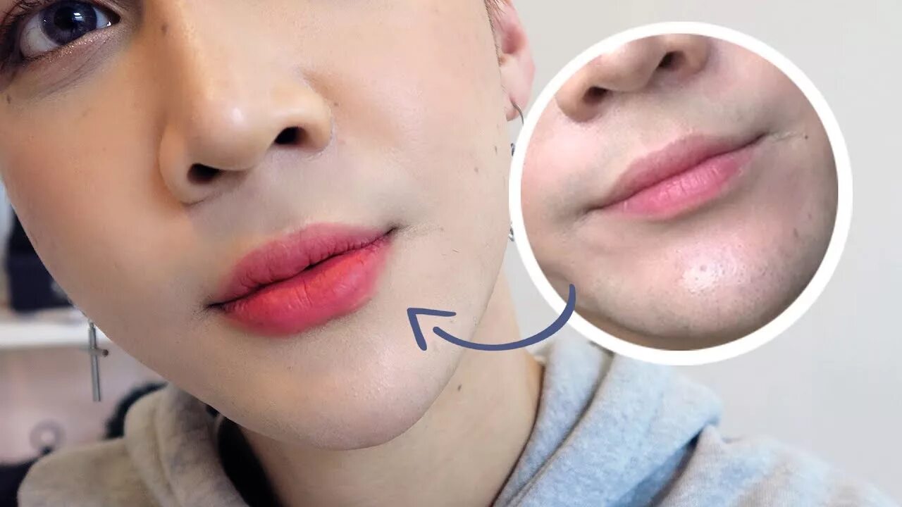 Формы губ для увеличения гиалуроновой кислотой. Корейский филлер для увеличения губ. Увеличение губ корея. Корейские губы. Корейские губы.
