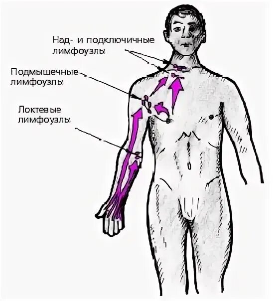 Лимфатическая система при онкологии 7 путей развития рака