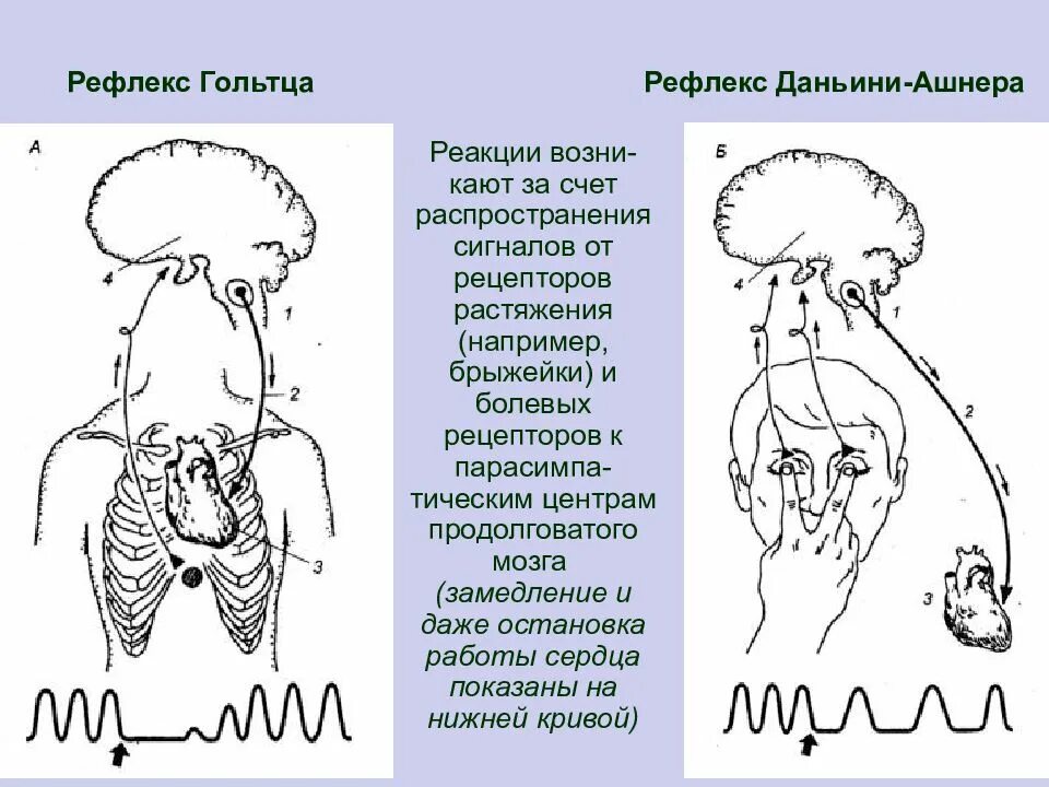 Опыт Данини Ашнера рефлекторная дуга. Рефлекс Данини Ашнера физиология. Рефлекс Данини Ашнера схема. Данини Ашнера рефлекс механизм. Рефлекс 10