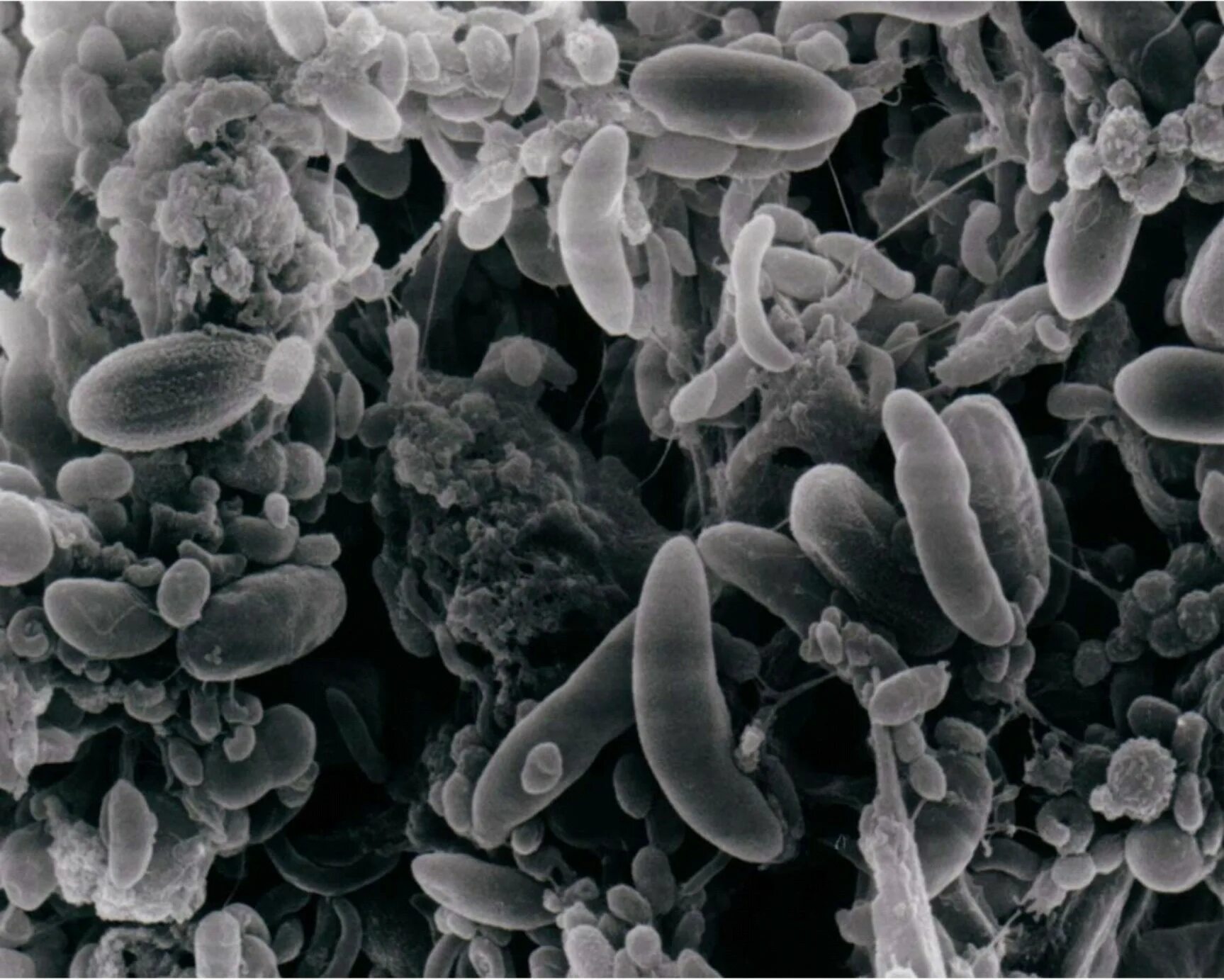 Рубцовые бактерии. Микробиота рубца жвачных. Микроорганизмы рубца. Микроорганизмы в рубце жвачных. Микрофлора рубца.